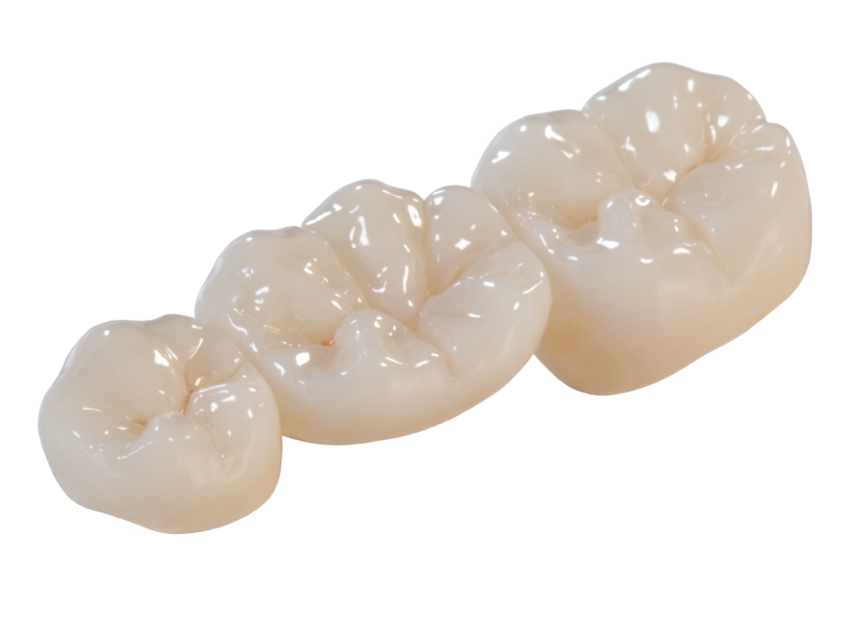 https://rddentalclinic.com/wp-content/uploads/2024/07/CROWNS-BRIDGES.png