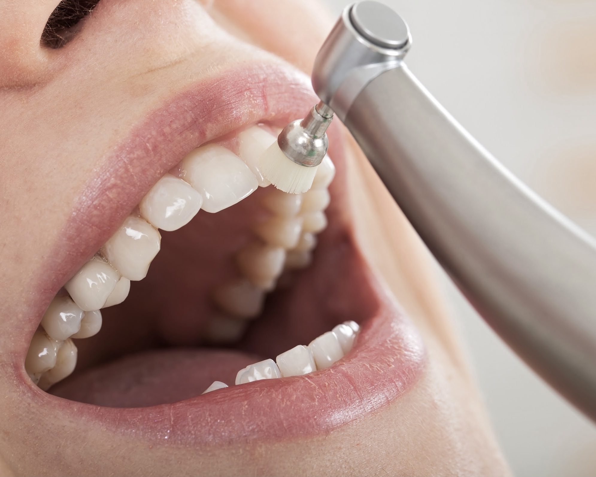 https://rddentalclinic.com/wp-content/uploads/2024/07/Dental-Cleaning-Consultation.jpeg