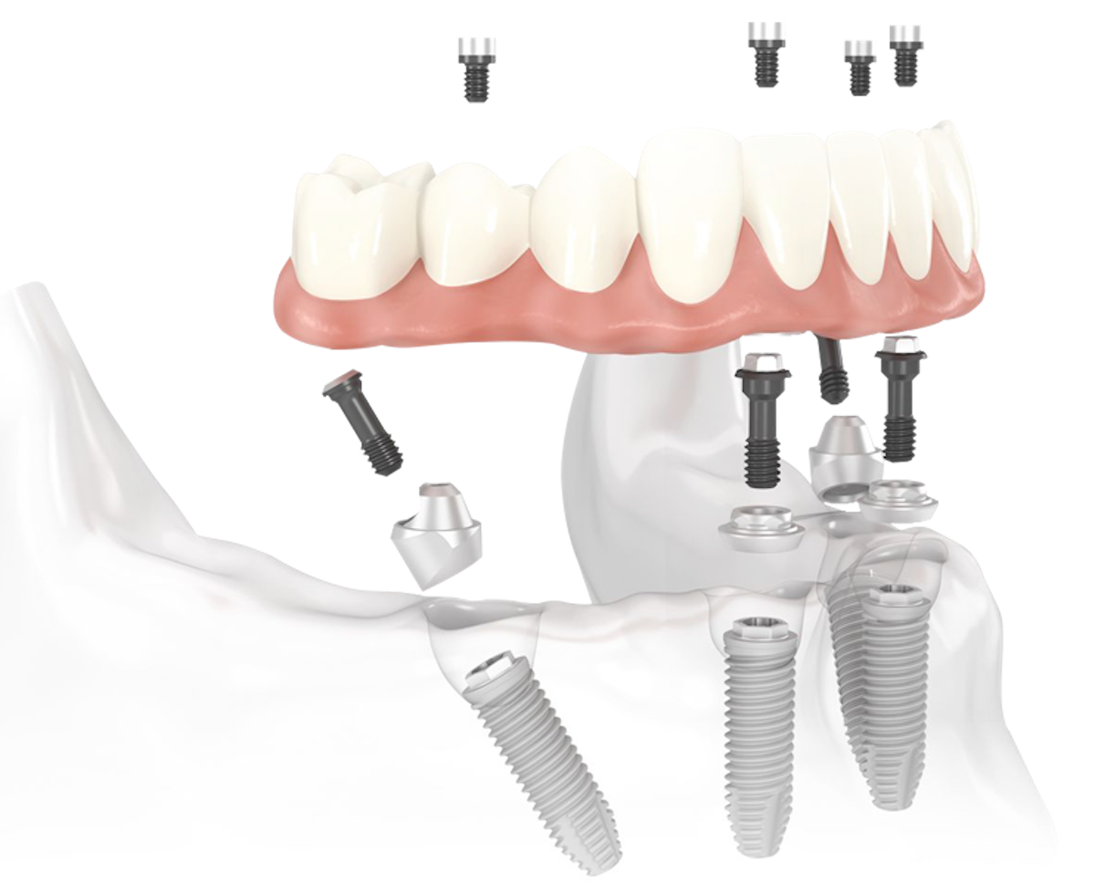 https://rddentalclinic.com/wp-content/uploads/2024/07/TYPES-OF-PROCEDURES.png