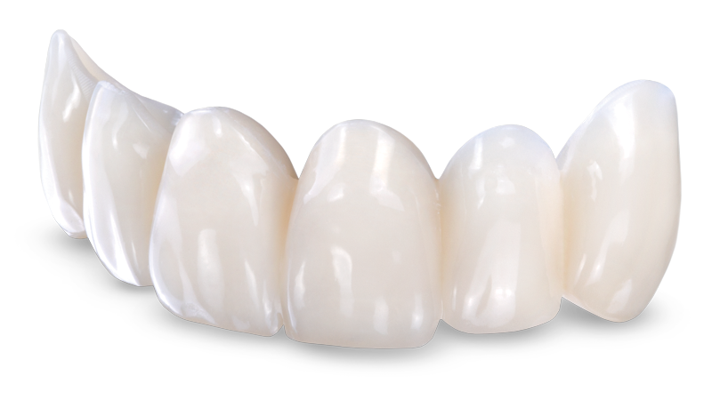 https://rddentalclinic.com/wp-content/uploads/2024/07/provitional-restorations.png